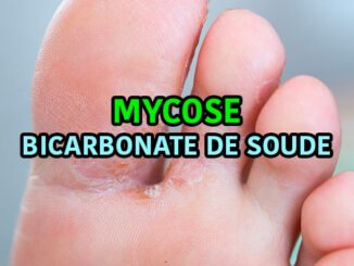 mycose au pied avec bicarbonate de soude