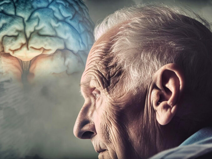 La maladie d'Alzheimer