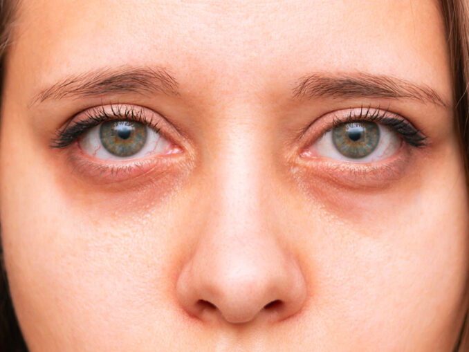 comment camoufler les cernes avec du maquillage
