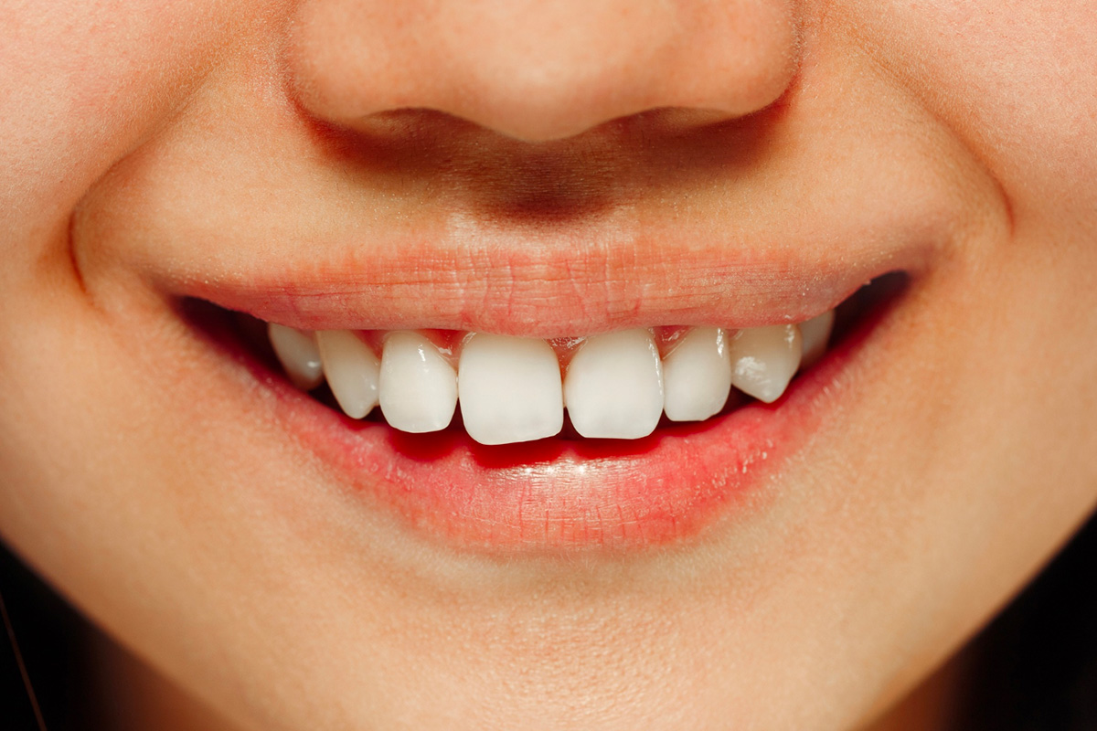 dents blanches