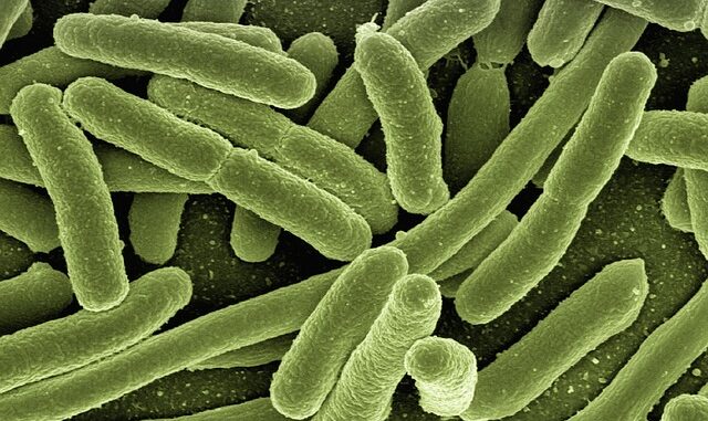 Quelle est la différence entre infection urinaire et cystite ?